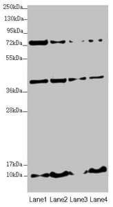 Polyclonal Rabbit anti-Human UQCC2 / MNF1 Antibody (IHC, WB)