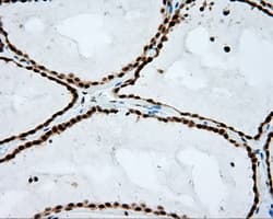 NPR3 Antibody (clone OTI4C3)
