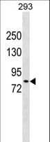 Polyclonal Rabbit anti-Human DCLK2 / DCAMKL2 Antibody (aa167-196, WB)