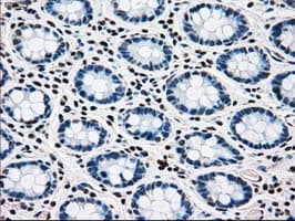 MAP2K4 / MKK4 Antibody (clone OTI1D6)