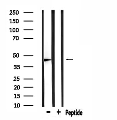 AUTL1 / ATG4C Antibody