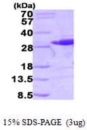 Human RALB Protein (Recombinant His)