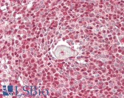 IHC-plus™ SNRPA1 Antibody (aa205-255)