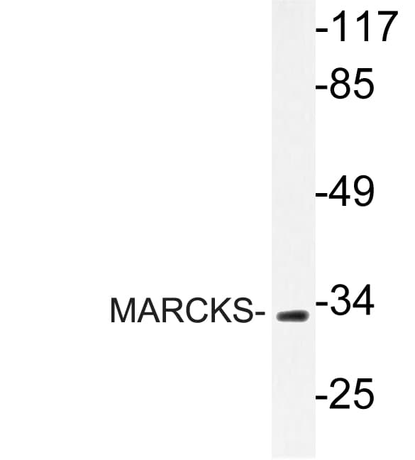 MARCKS Antibody (Arg157)