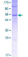 Human UBXD4 / UBXN2A Protein (Recombinant GST)