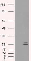 PRL / Prolactin Antibody (clone OTI9D12)
