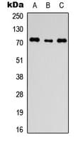 ANO1 / DOG1 / TMEM16A Antibody (C-Terminus)