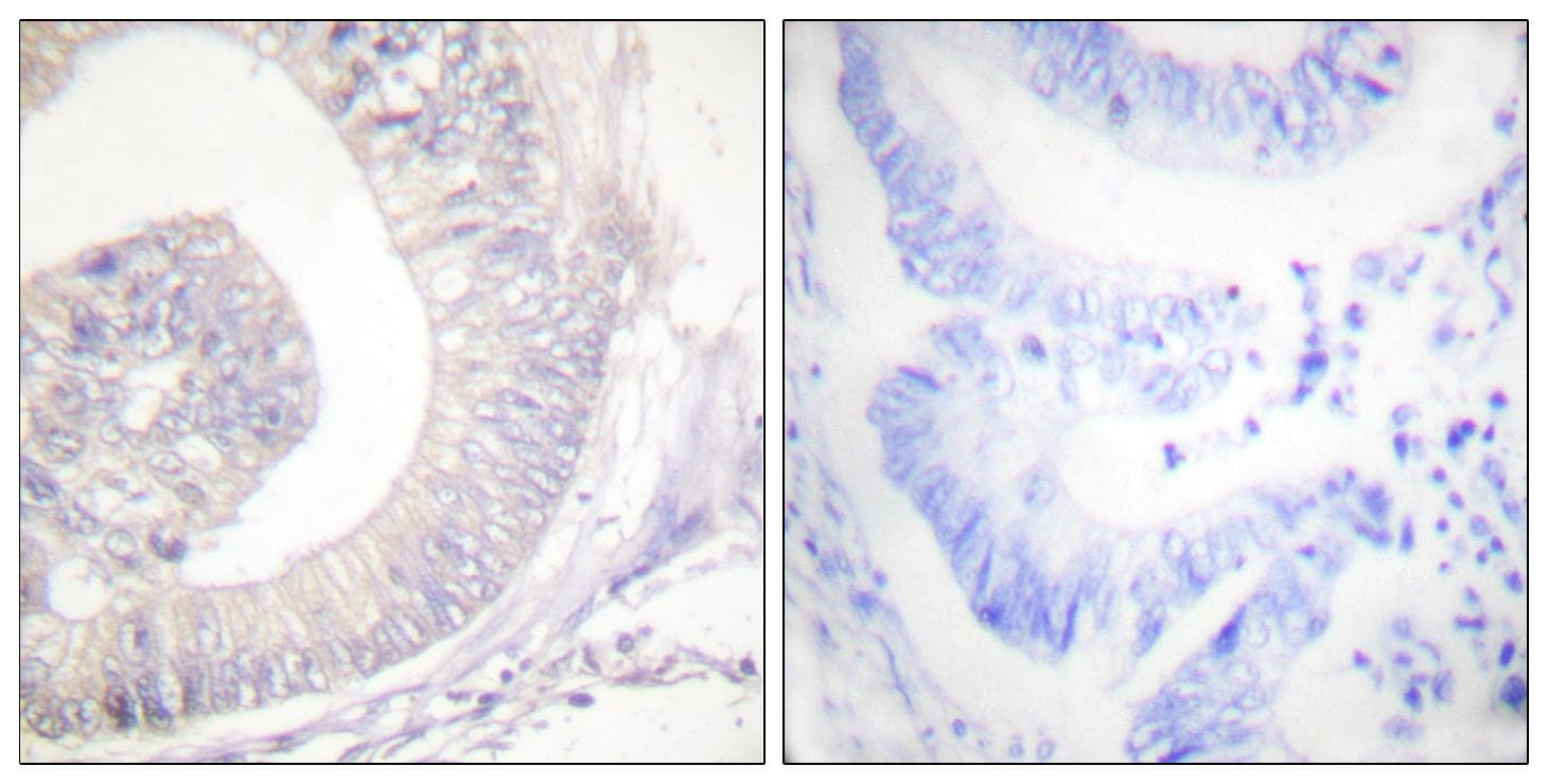LIPE / HSL Antibody (phospho-Ser855/554)