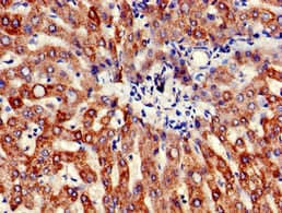 ATP5B / ATP Synthase Beta Antibody