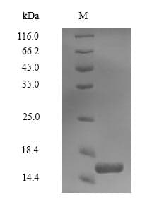 Human PLIN4 / S3-12 Protein (Recombinant 6His, N-terminus)