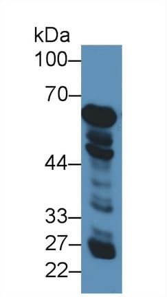 GLUD1/Glutamate Dehydrogenase Antibody (aa334-556)