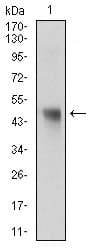 Monoclonal Mouse anti-Human NAPSA / NAPA / Napsin A Antibody (clone 10C4B8, aa20-158, IHC, WB)
