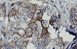 Monoclonal Mouse anti-Human ERBB2 / HER2 Antibody (clone OTI4G7, Carrier-free, aa676-1255, IHC, WB)