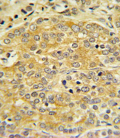 Polyclonal Rabbit anti-Human APOL1 / Apolipoprotein L Antibody (aa369-398, IHC, WB)