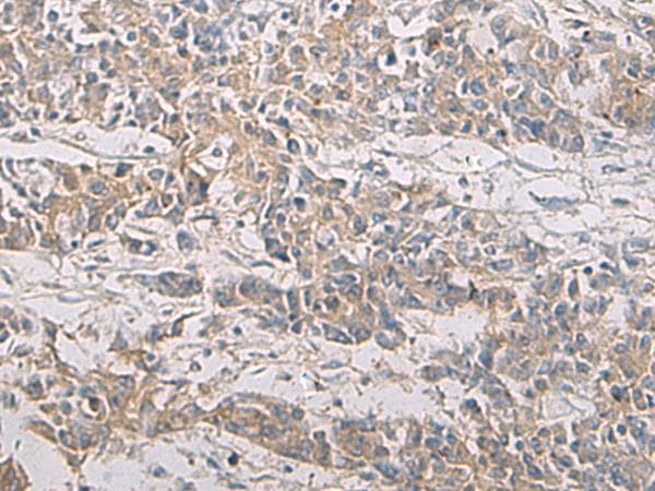 PA2G4 / EBP1 Antibody