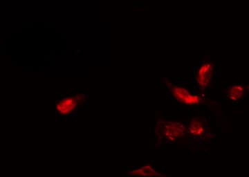 ZC3HC1 / NIPA Antibody