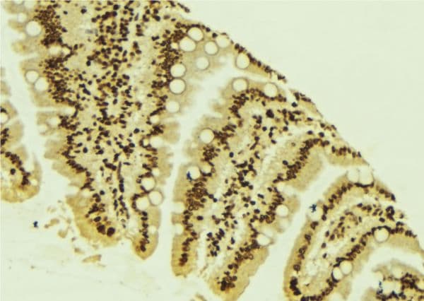 MDM2 Antibody