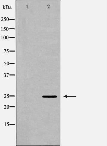 Polyclonal Rabbit anti-Human APCS / Serum Amyloid P / SAP Antibody (IHC, WB)