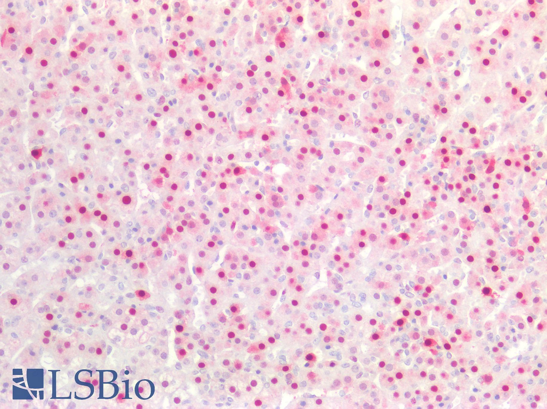 PathPlus™ CDKN1C / p57 Kip2 Antibody (Concentrated)