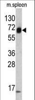 Polyclonal Rabbit anti-Human KRT4 / CK4 / Cytokeratin 4 Antibody (aa386-415, IHC, WB)