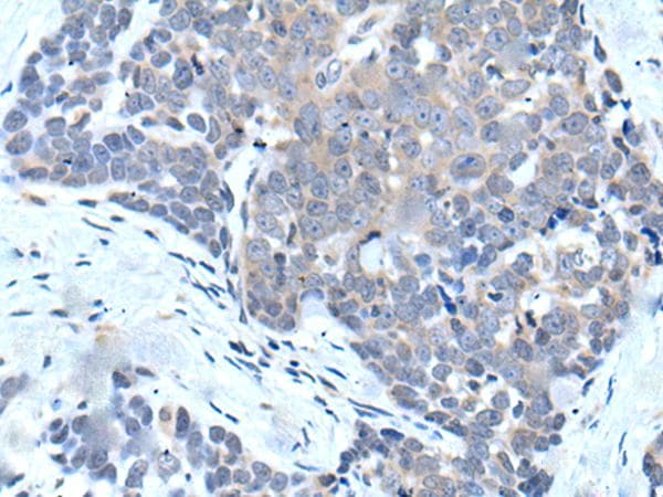 Polyclonal Rabbit anti-Human VPS35 Antibody (IHC, WB)