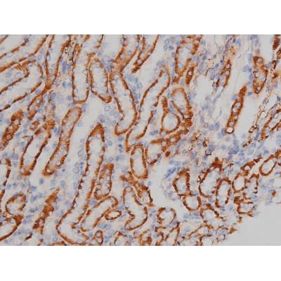 SNCA / Alpha-Synuclein Antibody (phospho-Ser129)