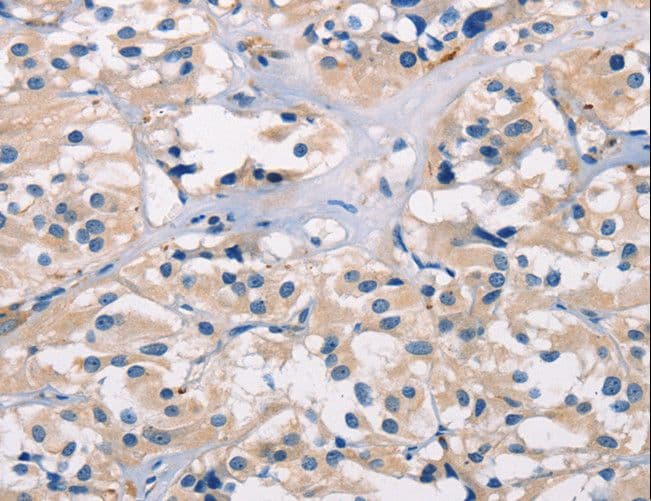 ADGRB1 / BAI1 Antibody
