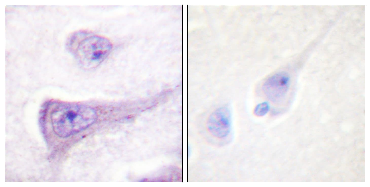 Polyclonal Rabbit anti-Human WAS / WASP Antibody (phospho-Tyr290, IHC, WB)