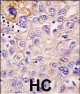 EIF2AK3 / PERK Antibody (Internal)
