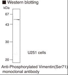 Monoclonal Rat anti-Human Vimentin Antibody (clone TM71, phospho-Ser71, IHC, WB)