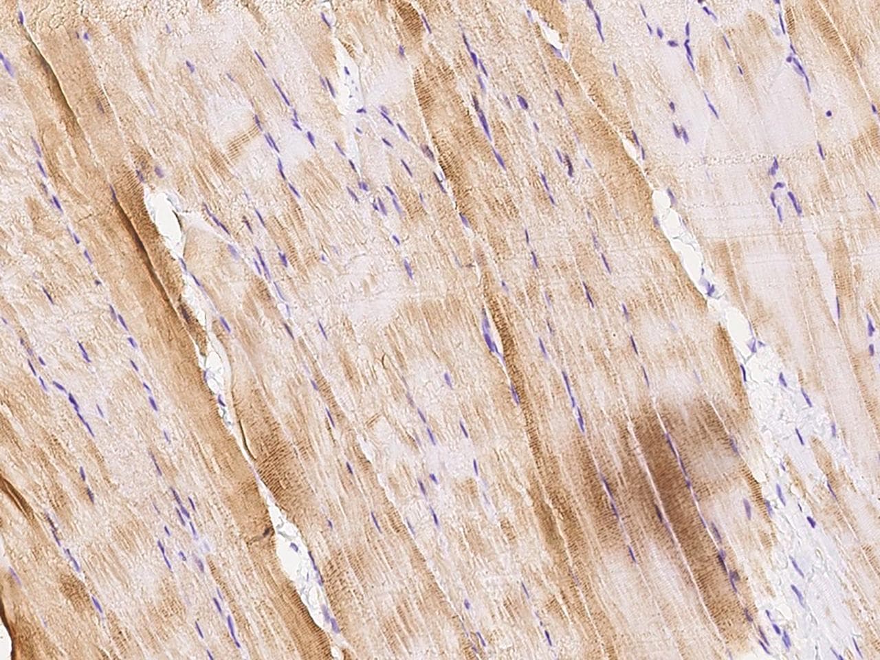 TPM2 Antibody (Preservative Free)