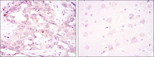 PRKAA1 / AMPK Alpha 1 Antibody (clone 2B7)
