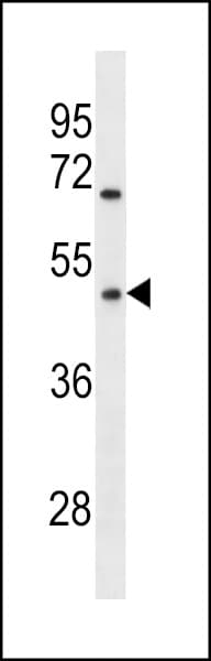 Polyclonal Rabbit anti-Human OR1Q1 Antibody (aa246-272, WB)