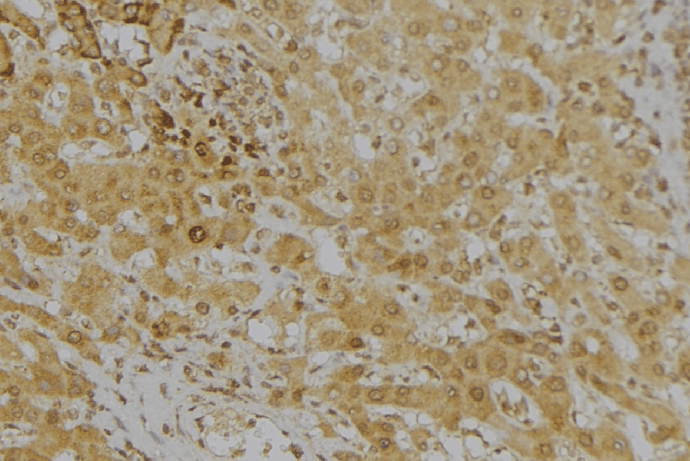 KMO Antibody