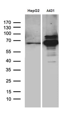 PCSK9 Antibody (aa153-692, clone OTI8E10, Carrier-free)