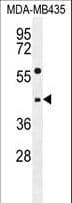 EPHX3 / Epoxide Hydrolase 3 Antibody (aa266-294)