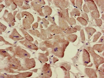 SLC12A7 / KCC4 Antibody