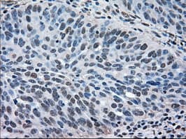 MAPK1 / ERK2 Antibody (clone OTI6F8)