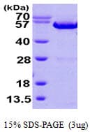 Human ANXA11 / Annexin XI Protein (Recombinant His)