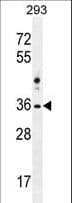 NKX1-2 Antibody (aa46-74)