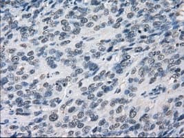 LTA4H / LTA4 Antibody (clone OTI5C10)
