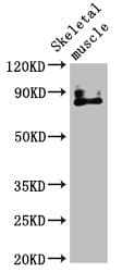 VRL1 / TRPV2 Antibody