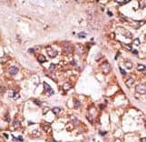 Polyclonal Rabbit anti-Human BIK Antibody (aa39-74, IHC, WB)