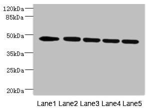 Polyclonal Rabbit anti-Human VRK1 Antibody (IHC, WB)