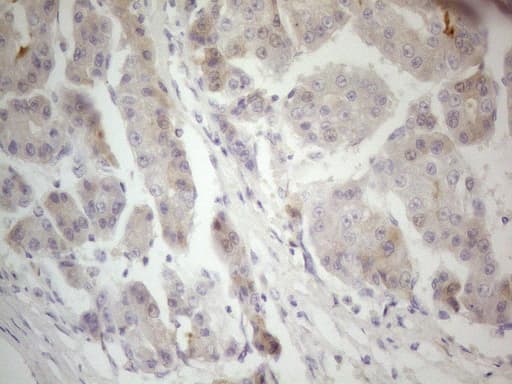 F12 / Factor XII Antibody (aa73-372, clone OTI1H5)