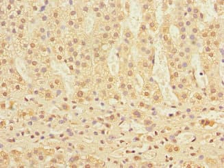 Polyclonal Rabbit anti-Human COMMD1 Antibody (IHC)