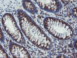 GCP60 / ACBD3 Antibody (clone OTI1B5)