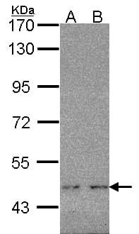 WT1 / Wilms Tumor 1 Antibody