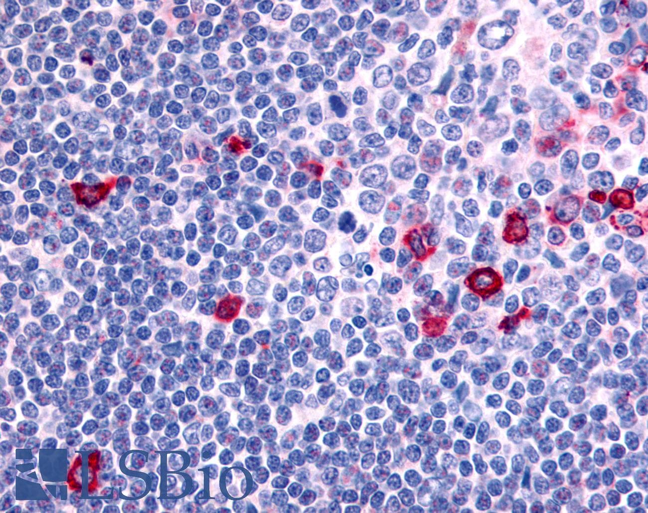 IHC-plus™ Polyclonal Rabbit anti-Human CNR2 / CB2 Antibody (Internal, IHC)