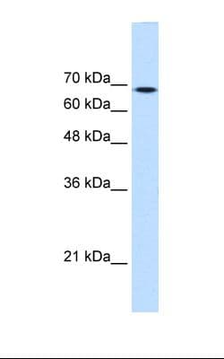 Polyclonal Rabbit anti-Human TGM2 / Transglutaminase 2 Antibody (aa431-480, IHC, WB)
